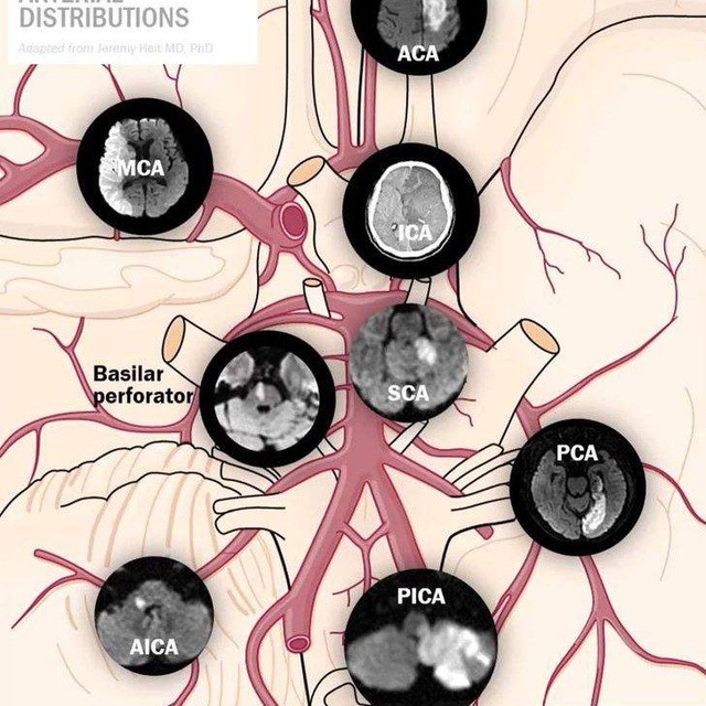 Neurology Top Books