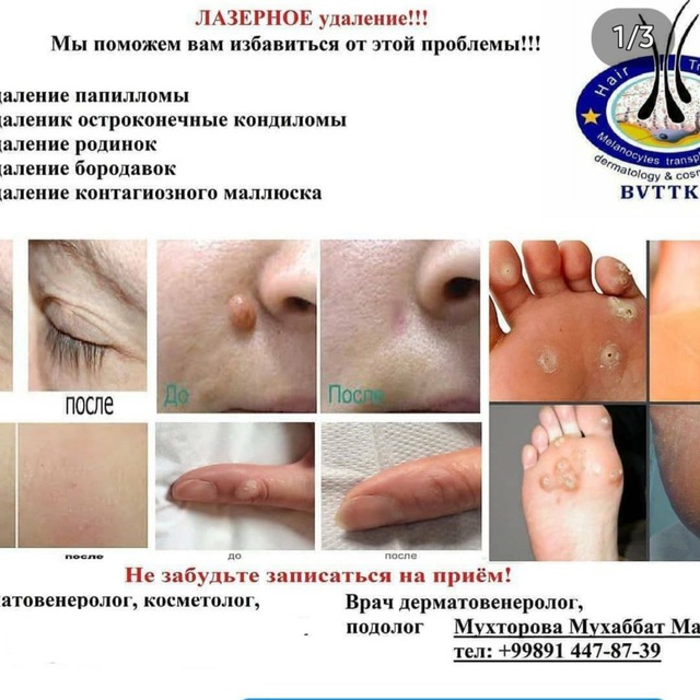 ДЕРМАТОВЕНЕРОЛОГ- ПОДОЛОГ- МАСЛАХАТИ